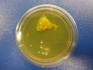 Slime mold culture.jpg